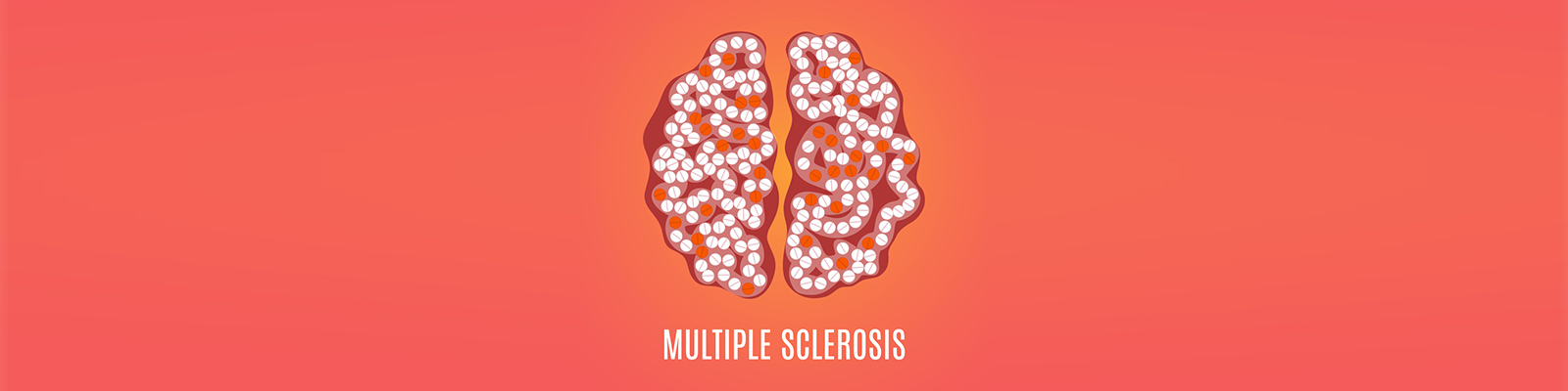 Living with MS? Take Our Multiple Sclerosis Quiz Today