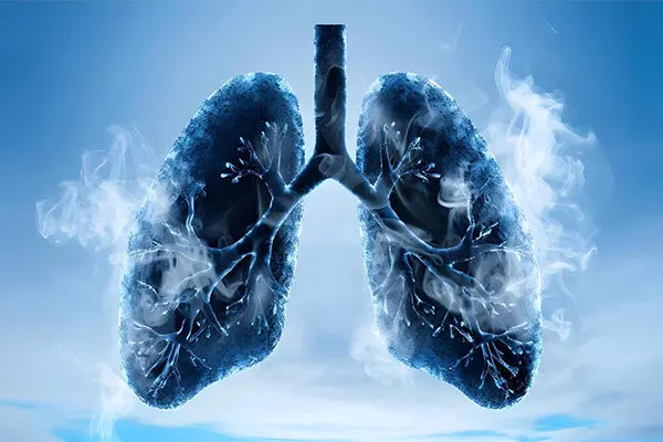 Peribronchial Cuffing