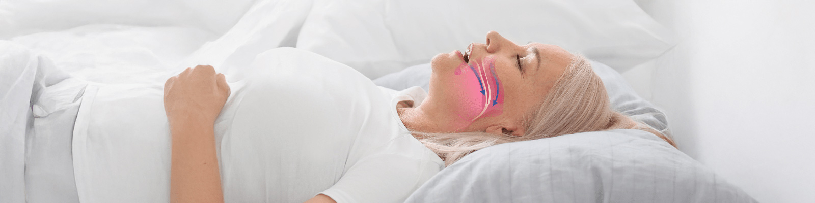 Does Sleep Apnea Cause Weight Gain?