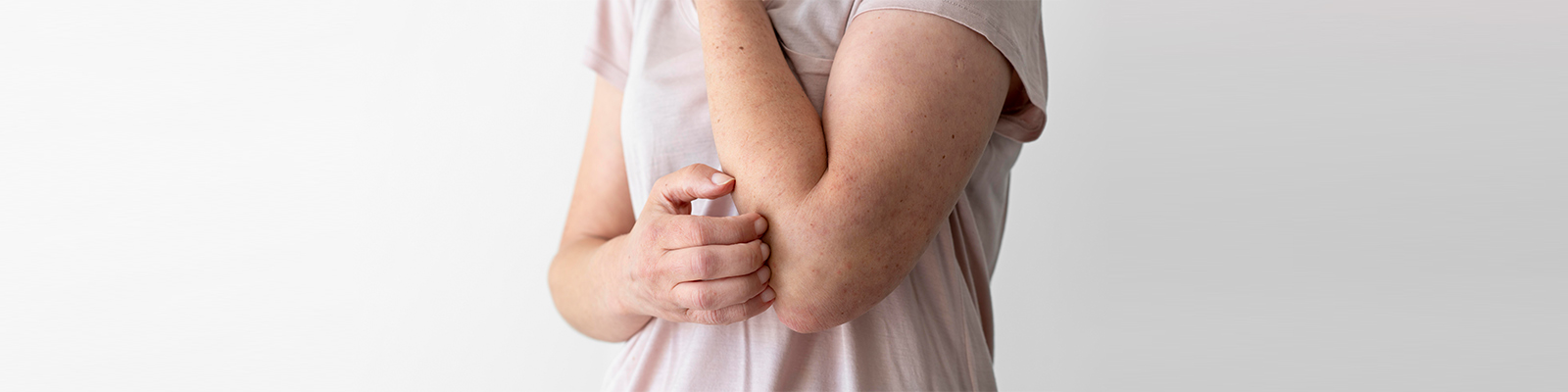 Multiple Sclerosis and Skin Rash