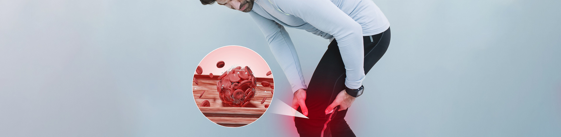 Understanding ANCA Associated Vasculitis
