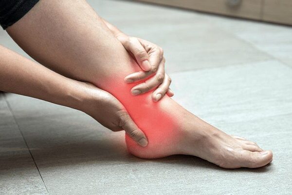 Gout in Ankle