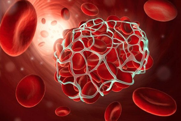 Lupus Anticoagulant