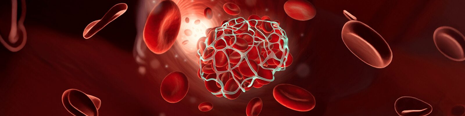 Lupus Anticoagulant