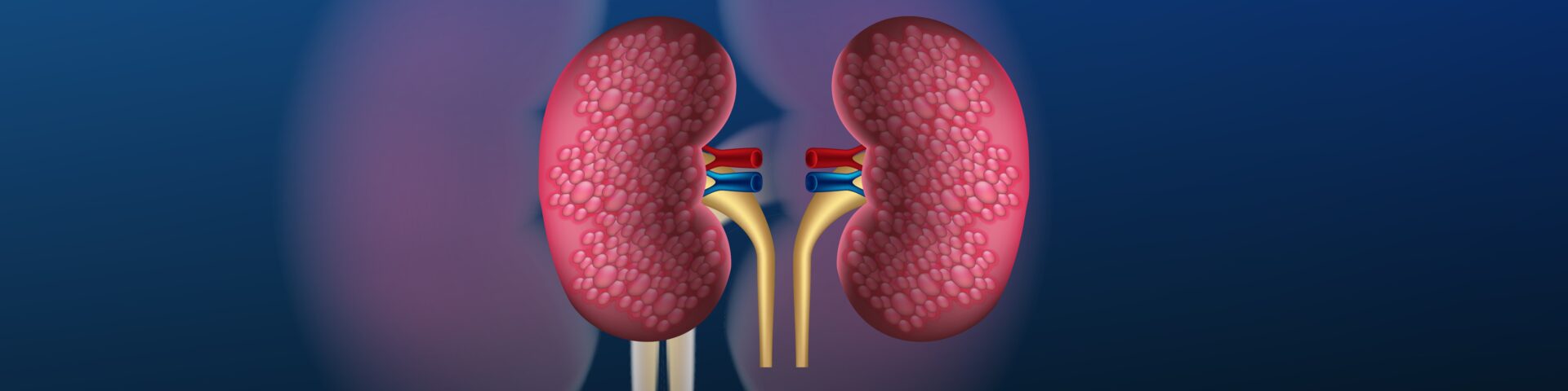 Lupus Nephritis Clinical Trials