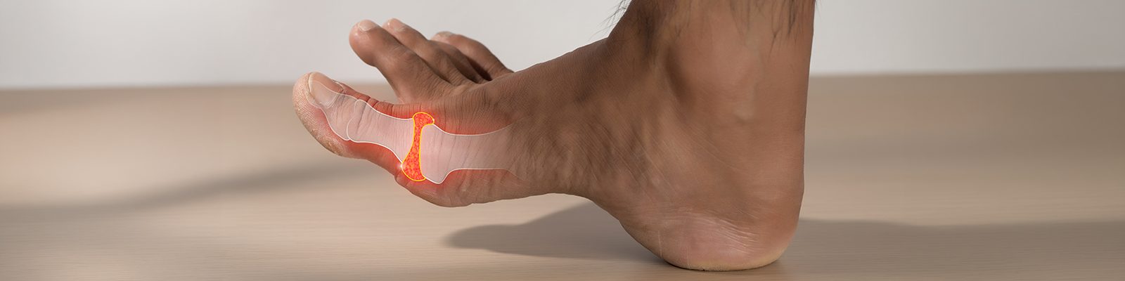 What Causes High Uric Acid in the Body